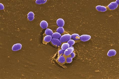 Enterococcus faecalis - wikidoc