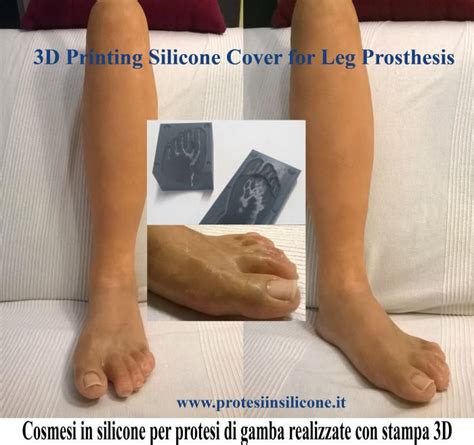 Creating Lifelike Prosthetics with 3D Printed Silicone | 3DPrint.com ...