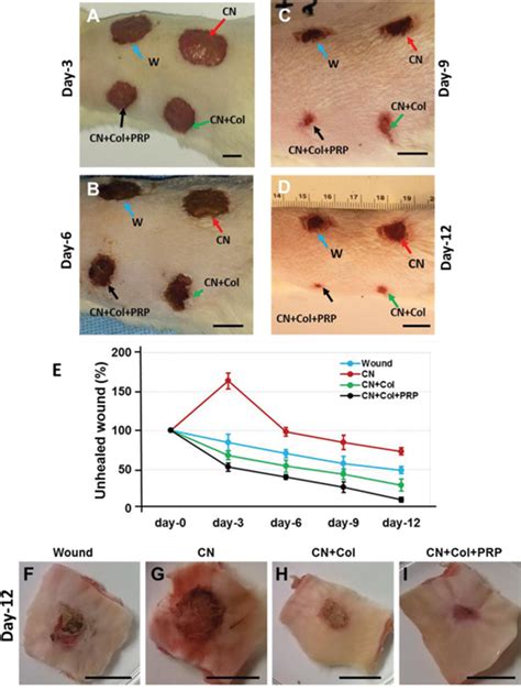 Oncotarget | A bioartificial dermal regeneration template promotes skin cell proliferation in ...