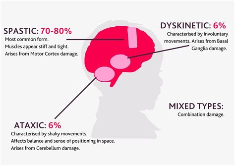 Types Of Cerebral Palsy Brain