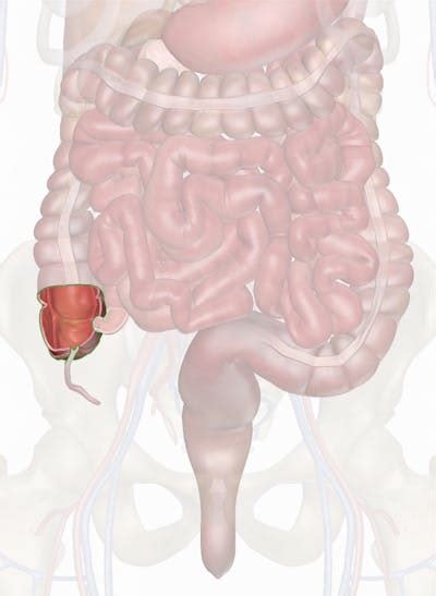 Cecum Location Diagram