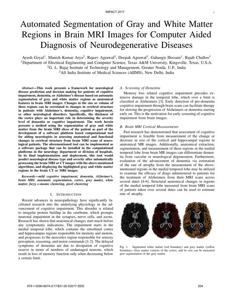 (PDF) Automated segmentation of gray and white matter regions in brain MRI images for computer ...