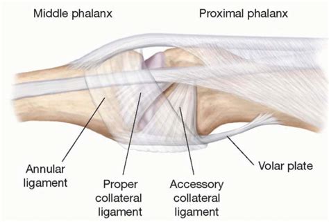 Ligament Injuries of the Hand and Wrist | Plastic Surgery Key