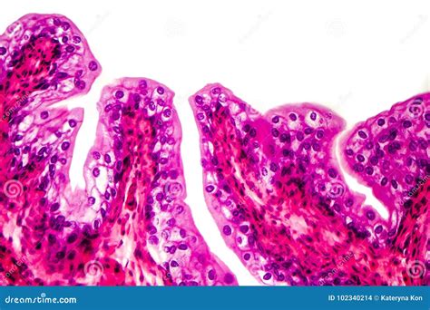 Transitional Epithelium Tissue Stock Photo - Image of medical, cell ...