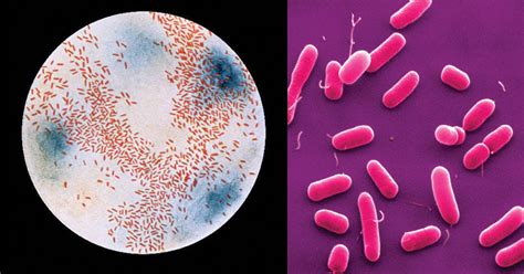 Biochemical Test of Haemophilus influenzae