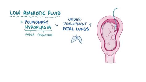 Potter's sequence - Google Search | Amniotic fluid, Math, Sequencing