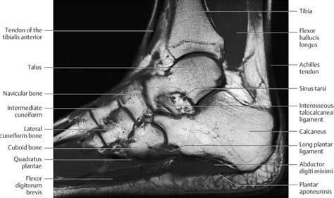 Ankle and Foot | Radiology Key