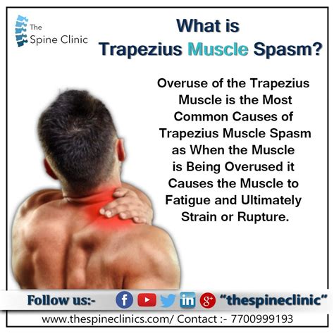 WHAT IS TRAPEZIUS MUSCLE SPASM. WHAT IS TRAPEZIUS MUSCLE SPASM | by The ...