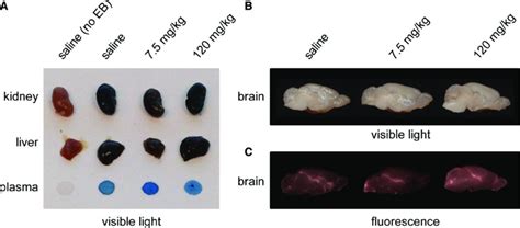 Abundant Evans blue dye uptake in the liver, kidney, and plasma but not... | Download Scientific ...