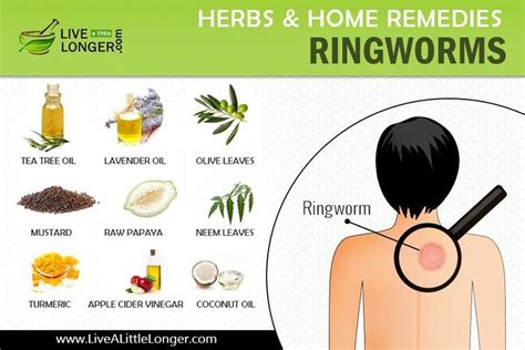 Pin by Kristy Turner on Hacks & Remedies i had no idea about. ※﹋o﹋※ in 2020 | Ringworm remedies ...