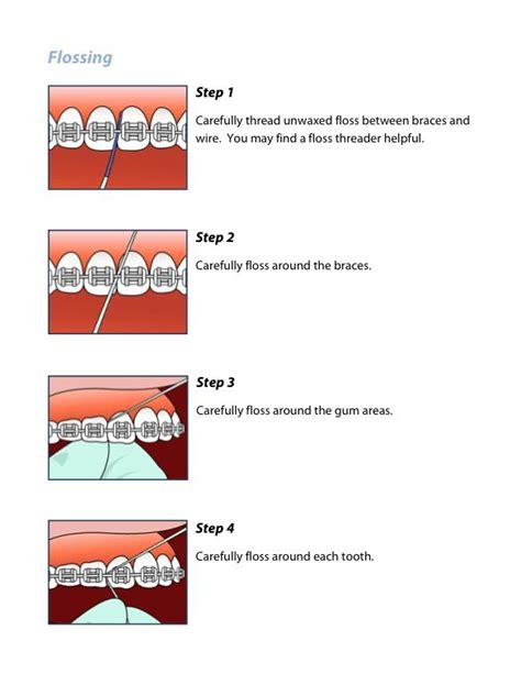 Take these 4 easy steps to floss with braces | Flossing, Flossing braces, Dental braces