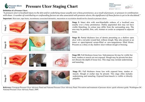 Pressure Ulcer Scoring