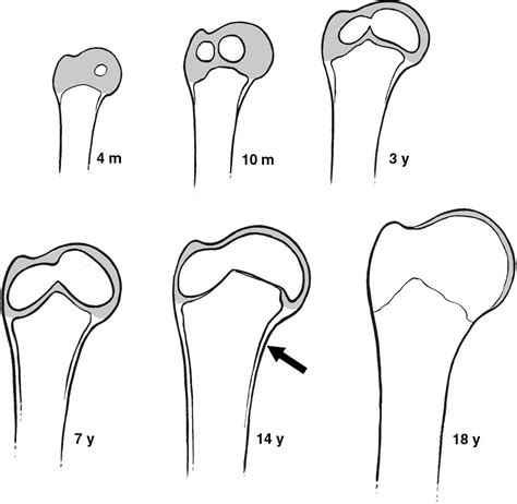 Ossification Center