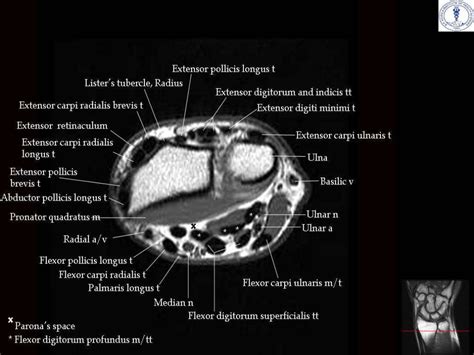 Anatomy and imaging of wrist joint (MRI AND XRAY)