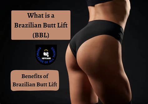 What Is A Brazilian Butt Lift (BBL)? | Benefits Of Brazilian Butt Lift ...