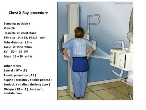 Pa Chest X Ray Technique