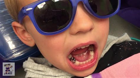 Why Put Silver Caps On Baby Teeth - Kristin Morton Hochzeitstorte