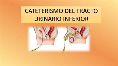 Cateterismo del tracto urinario inferior | Esther Saona | uDocz