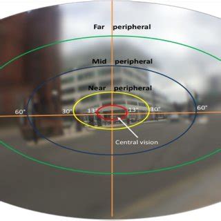 Normal Vs. Tunnel vision example. The top picture shows a healthy ...