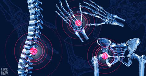 Psychogenic Pain: 10 Types of Physical Pain Linked to Emotional Stress - Live Love Fruit