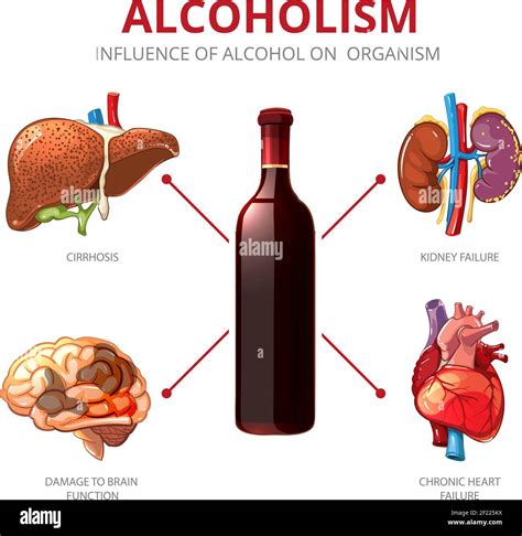 The effects of alcohol consumption Stock Vector Images - Alamy