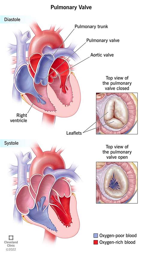 Pulmonary Valve