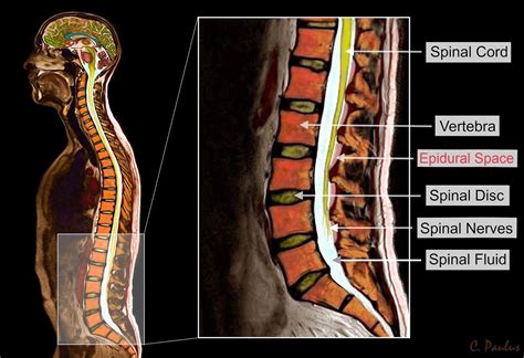 Pin on Mri Scans