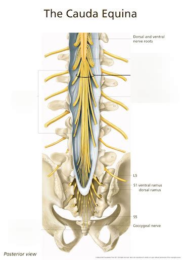 Cauda Equina Diagram | Quizlet