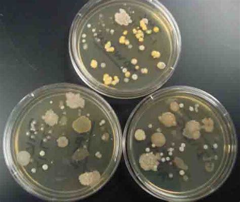 Bacterial Growth Media & Cultures Images: Free photographs from Science Prof Online