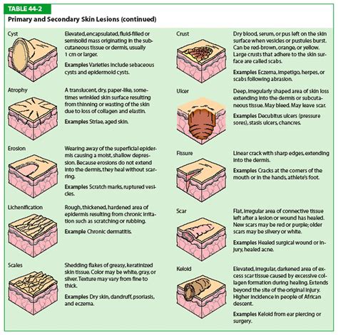 Primary Skin Lesions Chart | Porn Sex Picture