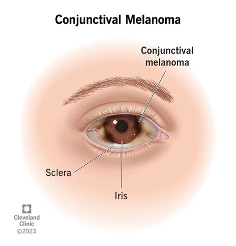 Conjunctiva: Anatomy, Function Common Conditions, 47% OFF