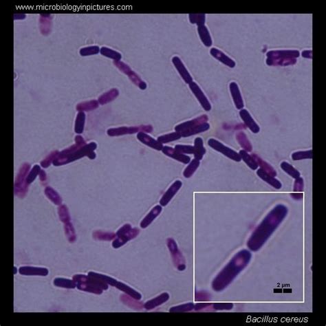 Bacillus Cereus Spore