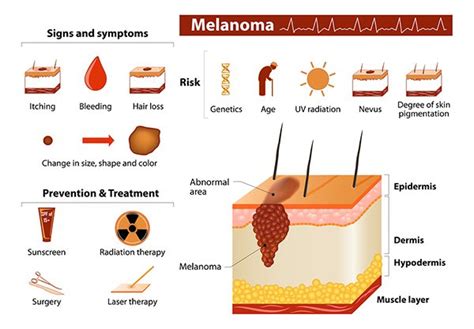 Cancerous Moles: What to Look For