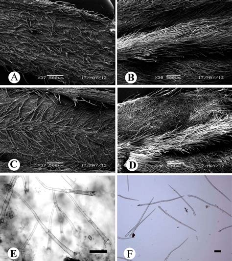 Trichome morphology of leaves under scanning electron microscope and... | Download Scientific ...