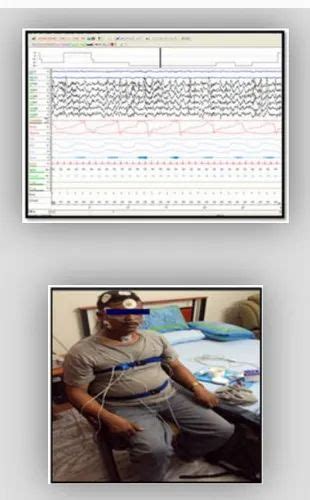 Nocturnal Polysomnography(NPSG) at best price in Thane | ID: 22355138188