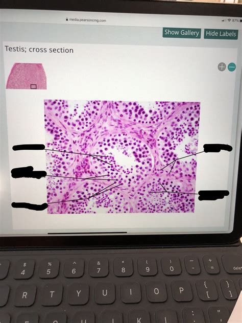 Testis cross section Diagram | Quizlet