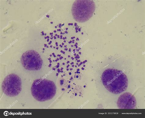 Human chromosomes under light microscope. (1000x magnification) — Stock ...