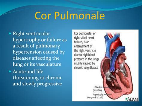 PPT - Respiratory failure & Cor Pulmonale PowerPoint Presentation - ID:2241652