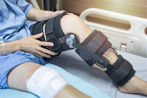 Do I Need to Wear a Knee Brace After ACL Surgery? — Dr. Bill Sterett