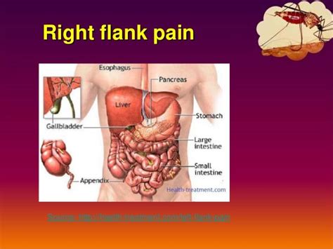 Left flank pain – Causes, symptoms, diagnosis and treatment