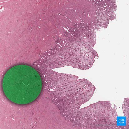 Myometrium: Histology and anatomy | Kenhub