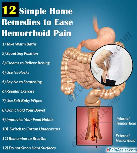 12 Simple Home Remedies to Ease Hemorrhoid Pain