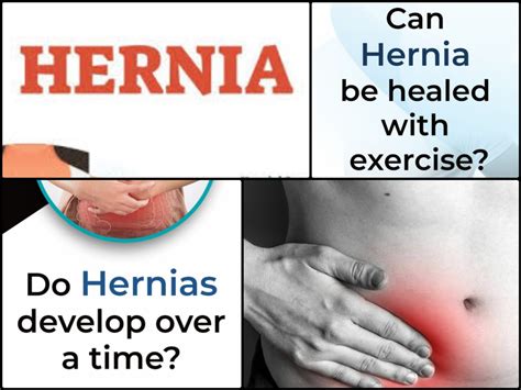 Hernia Types Causes Symptoms Diagnosis Treatment | Porn Sex Picture