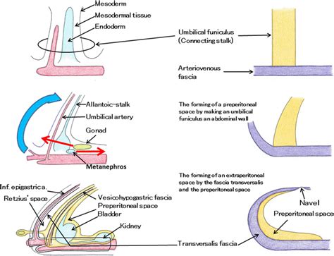 The forming of an extraperitoneal space. The forming of a preperitoneal... | Download Scientific ...