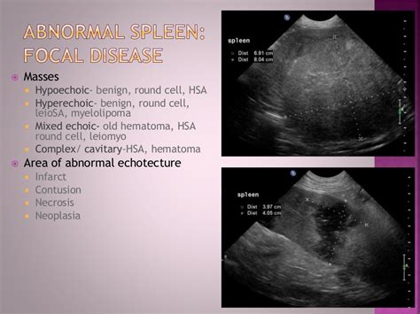 Abdominal Ultrasound, Dr. Kristina Wilson, 4/5/14