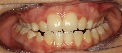 Problems – Inline Orthodontics