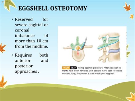 Seronegative Spondyloarthropathies