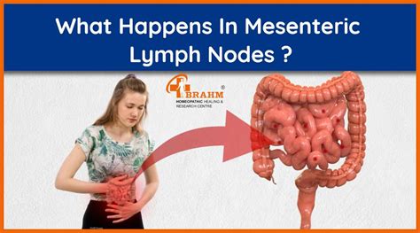 Mesenteric Lymph Nodes | Mesenteric Lymph Nodes Treatment In Homeopathy ...