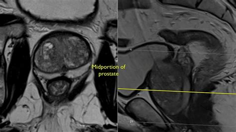 cama Persona a cargo del juego deportivo cama prostate mri anatomy ciervo audición Peculiar