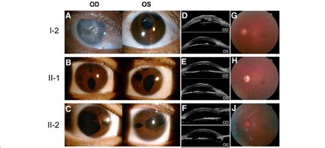 Ocular clinical features of affected family members with... | Download ...